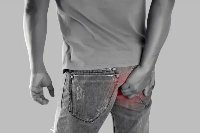 fissure treatment in Indore, best fissure doctors in indore, anal fissure treatment in indore