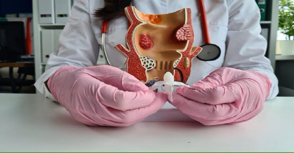 fistula laser surgery in indore,best fistula treatment in indore, fistula treatment in indore, laser fistula treatment in indore,