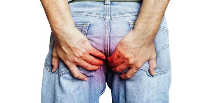 anal fistula doctor in indore