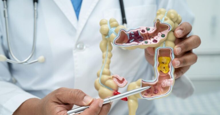 best piles doctor in indore